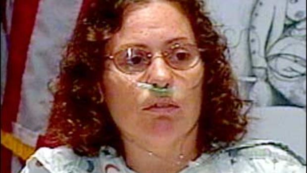 The Early Show, 46-year-old <b>Sandy Lanier</b>, Doctors in Baltimore performed an <b>...</b> - image570792x