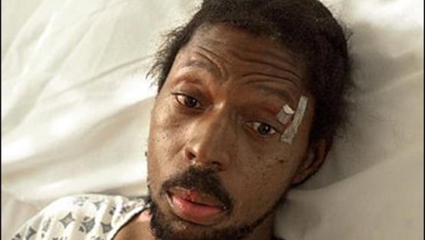 Billy Ray Johnson recovers in his room in Linden Memorial Hospital in Linden, Texas, Tuesday, Oct. 7, 2003. Johnson was found beaten in a roadside ditch on ... - image577328x