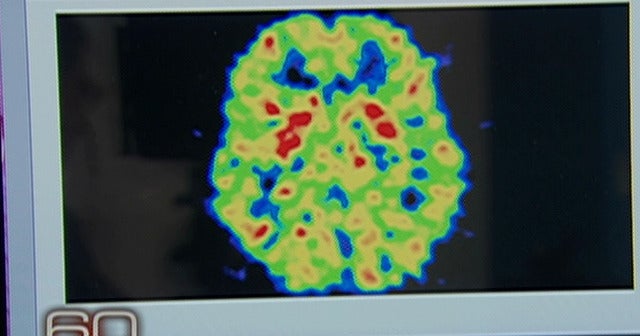 best medicine for brain enhancement Best medicine for brain enhancement image 6