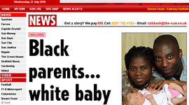 Black parents say they gave birth to white baby.
