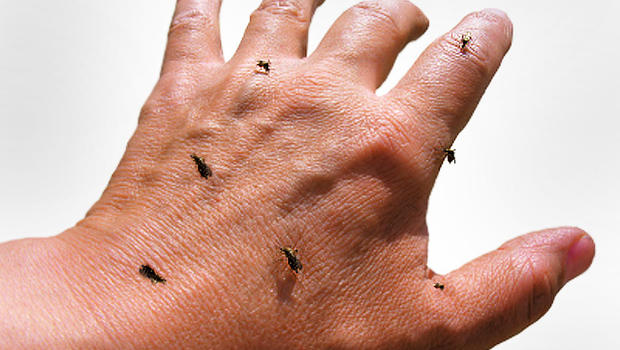 hand skin diseases