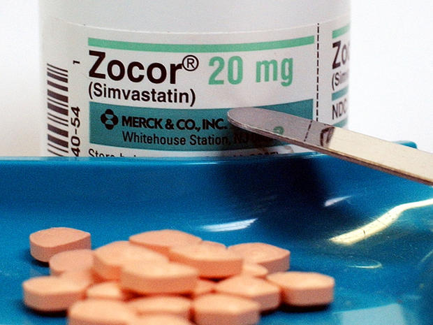 zocor generic