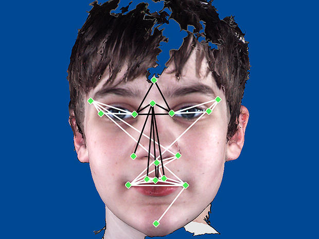 is-it-autism-facial-features-that-show-disorder-photo-7-pictures-cbs-news