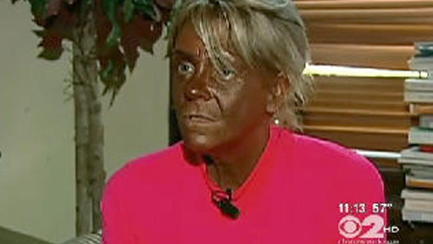 Tanning Mom Patricia Krentcil Banned From Over 60 Tanning Salons