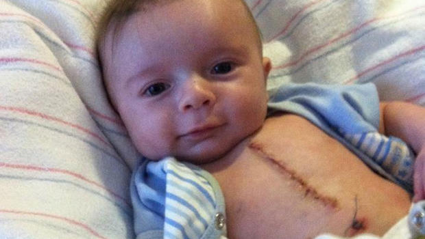 Web Falls In Love With Ridiculously Good Looking Surgery Baby CBS News