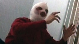 Sergei Filin is seen with his face covered in bandages following the acid attack.