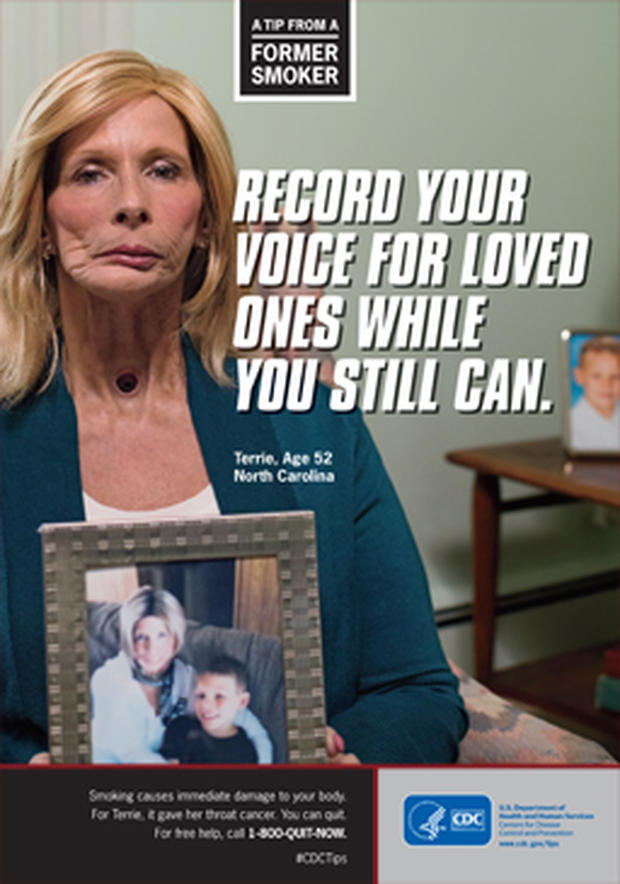 Woman in graphic anti-smoking ad dies from cancer - CBS News