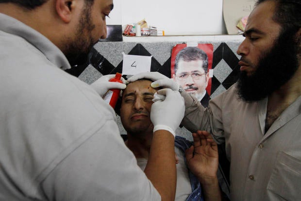 A wounded supporter of Egypt's ousted President Mohamed Morsi receives treatment at a local hospital in Cairo