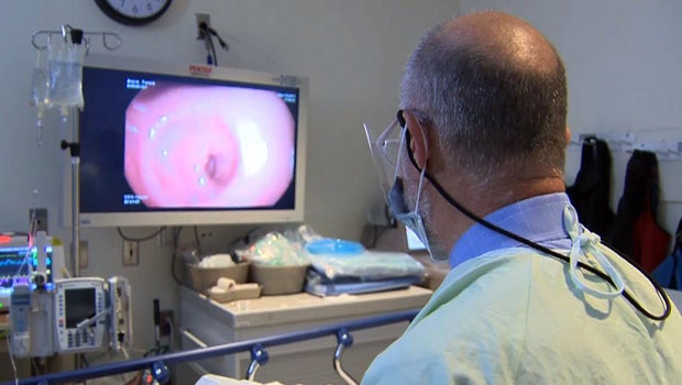 A colonoscopy can detect colon cancer early.
CBS News