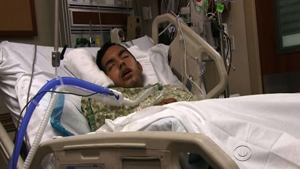 tasers-teenager-injured.jpg