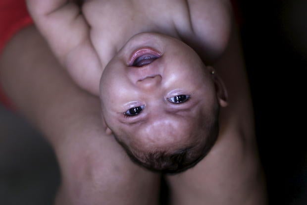 zika.jpg
