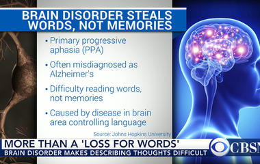 New study: 'Loss for words' can be rare brain disorder