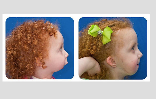 lexis-jaw-before-and-after.png