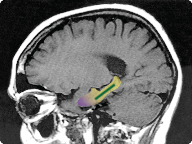 brain-scan-flavonol-study.jpg 
