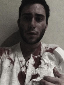 Jake Nolan bloody selfie