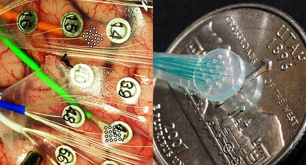 Left: Electrode grids at the end of the green and orange wires collect speech signals. Right: Close up of new electrode array.