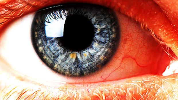 12 scary things your eyes say about your health 