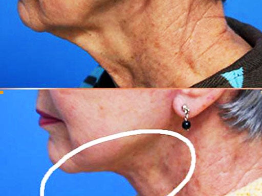 Plastic Surgery 10 Secret Signs