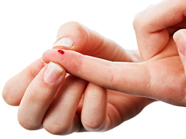 finger, blood, diabetes, blood test, istockphoto, 4x3
