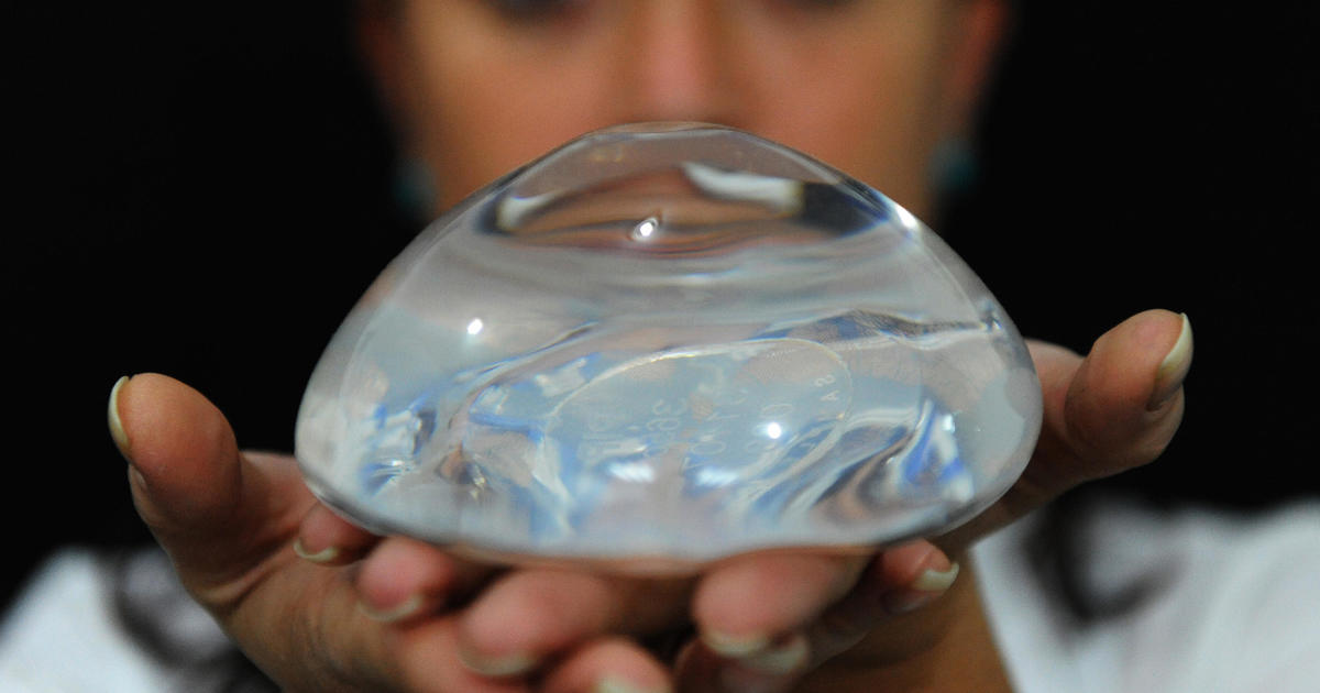 83-Year-Old Gets Breast Implants To Stay Young - CBS Los Angeles