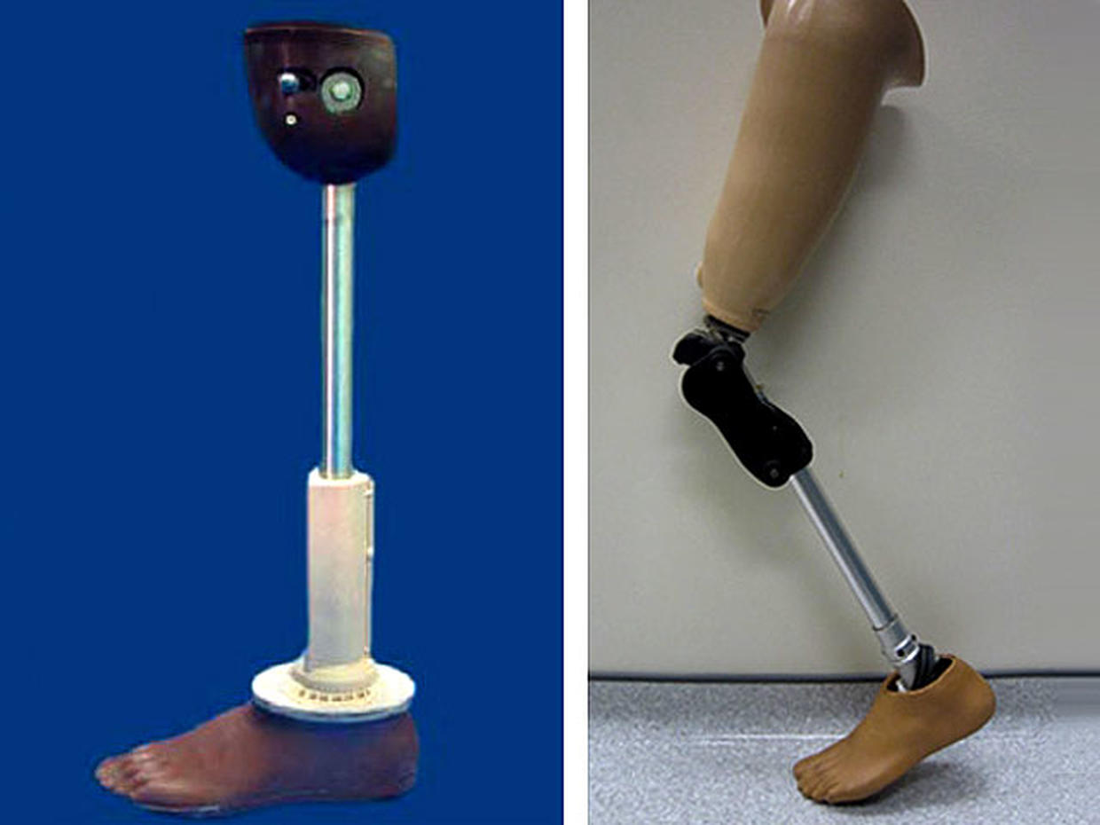 Cost a leg. Протез ноги. Современные протезы ног. Бионический протез ноги.