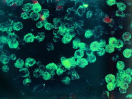 naegleria