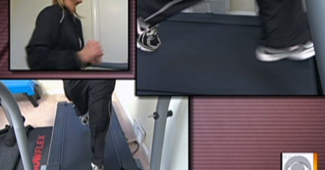 Treadmills Danger at our feet CBS News