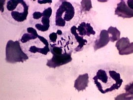 Listeria outbreak