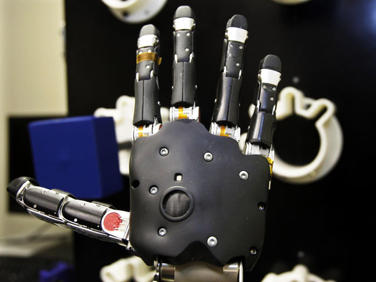 Robotic arm lets paralyzed man touch girlfriend Photo 1 Pictures