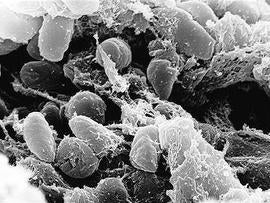 yersinia pestis, black plague