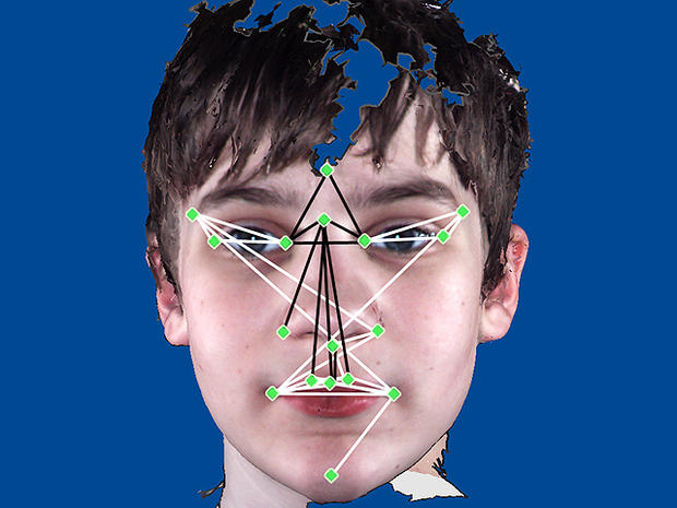 children-with-autism-have-distinct-facial-features-study-cbs-news