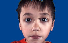 Is it autism? Facial features that show disorder 