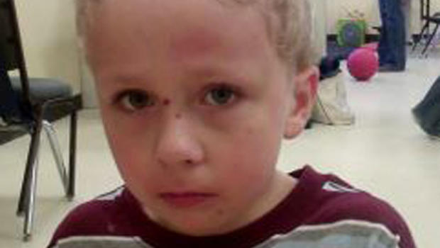 Missing Va. autistic boy found alive after 6-day search - CBS News