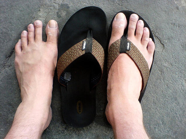 flip flops for swollen feet