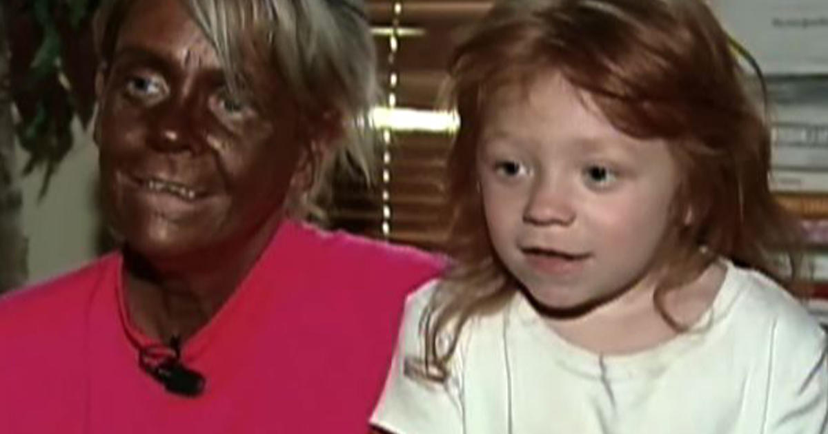 Mother Accused Of Letting Daughter 6 Use Tanning Bed Cbs News