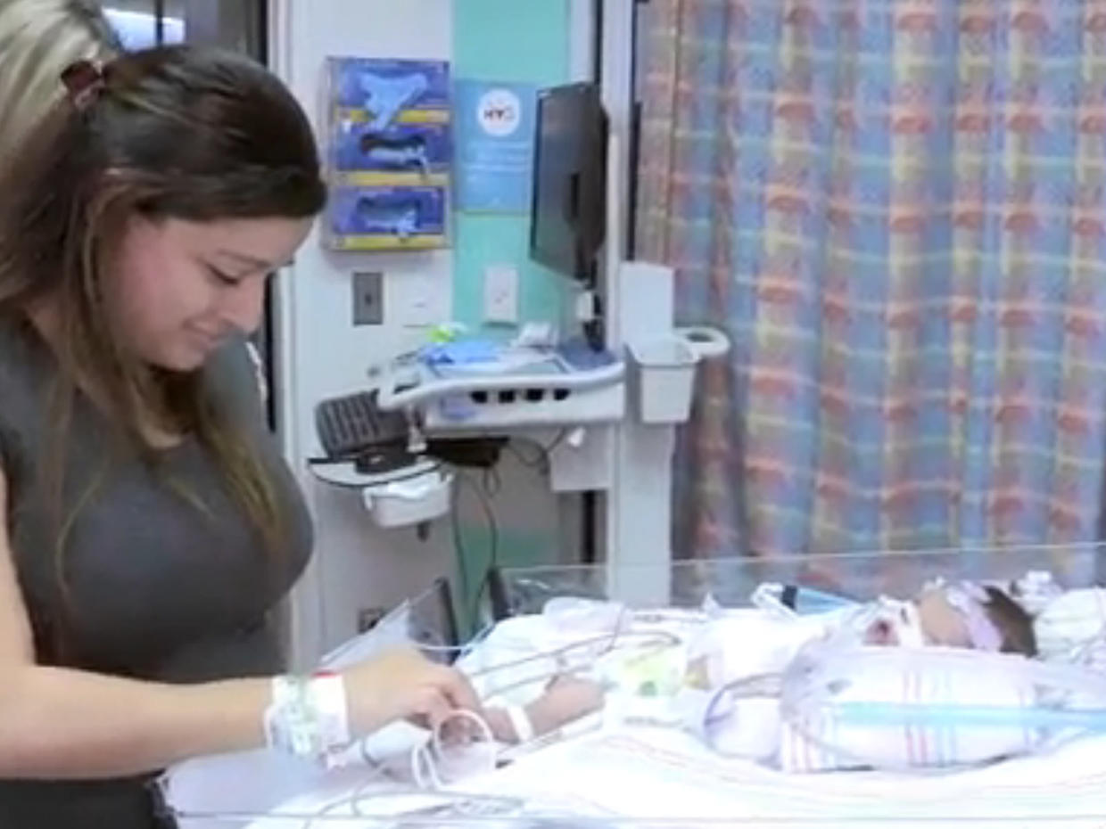 Baby Born With Heart Outside Body Cbs News