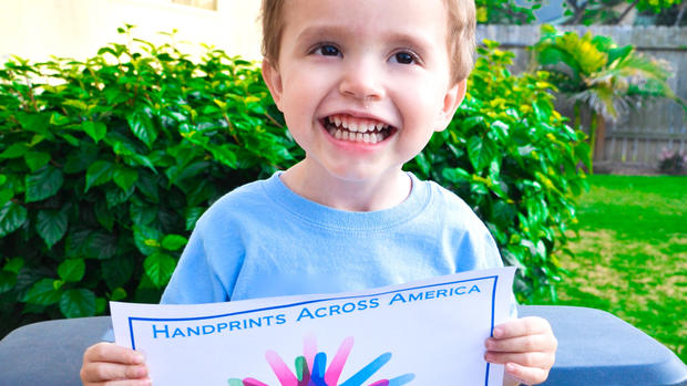 Rare Disease Day: Handprints across America 