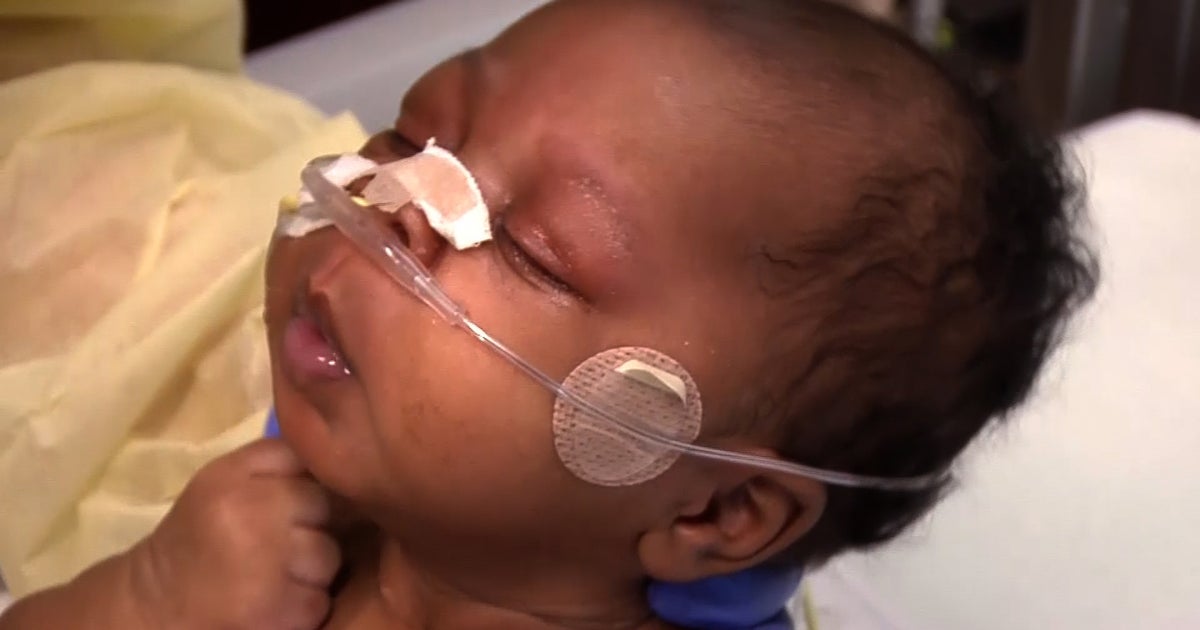 2010 Calif. whooping cough outbreak linked to vaccine-averse parents