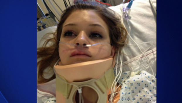 16 Year Old Girl Falls 3000 Feet In Skydiving Accident And Survives 