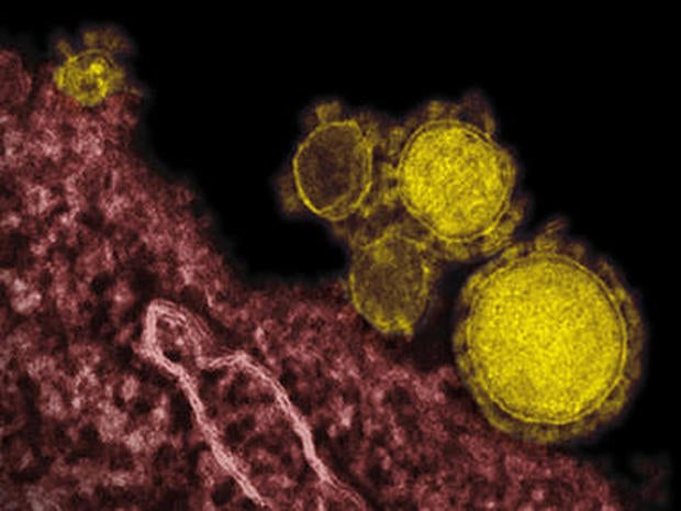 mers-virus-ap13061817965-380x285.jpg