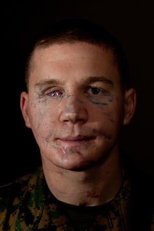 Opinion Kyle carpenter before and after surgery opinion Seems Kyle carpenter before and after surgery authoritative message