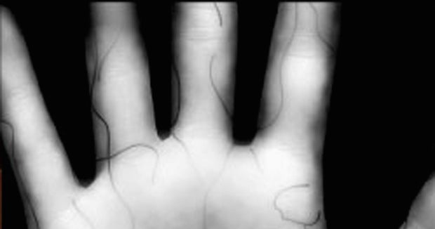 How biometric palm scans help keep hospitals secure CBS News