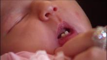 health0109babyteeth328737640x360.jpg