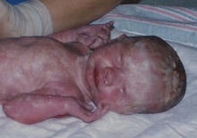 kirsten-morrise-2-15-93-minutes-old.jpg