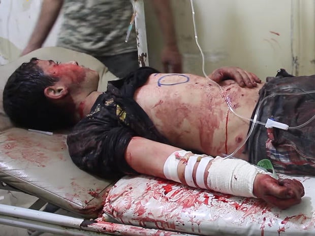 A boy injured in a strike that destroyed the al-Quds hospital in southern Aleppo, Syria, recieves treatment at another facility in the front-line city, in a screengrab from video posted online by Syrian anti-government activists