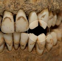 teeth.jpg