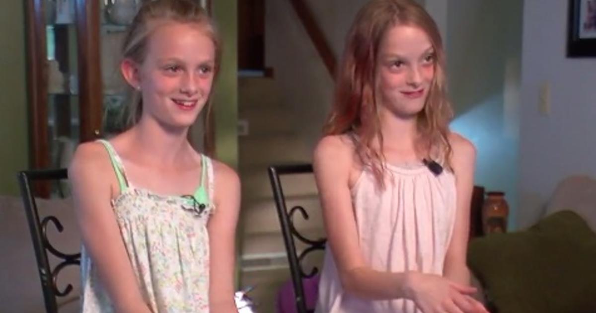 North Dakota Conjoined Twins Celebrate 10 Years Apart Cbs News 