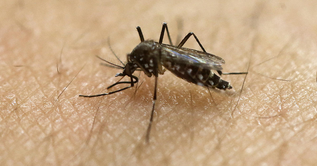 Zika may linger in semen for shorter time than thought