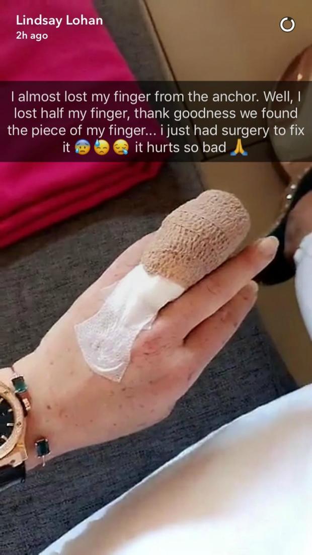 Lindsay Lohan Says She Lost Fingertip In Boating Accident Cbs News