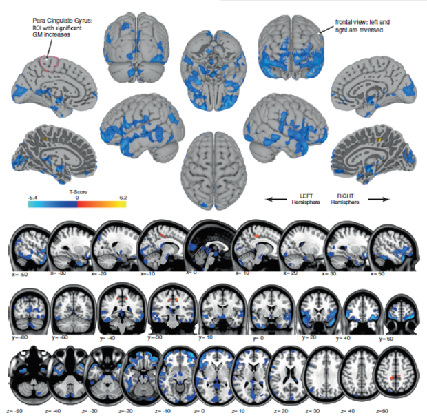 astronaut-mri-brain-shape.png